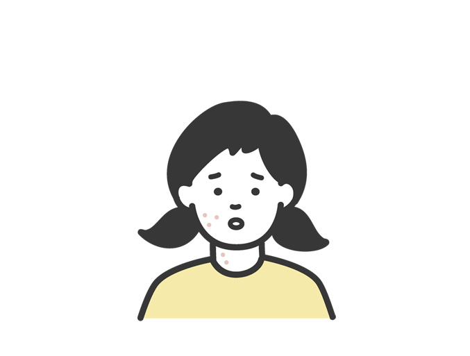アトピー性皮膚炎 お子さまの場合