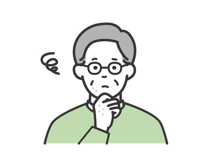 アトピー性皮膚炎 ご高齢の方の場